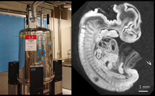以百分之一毫米的分辨率对人类胚胎进行核磁共振观察